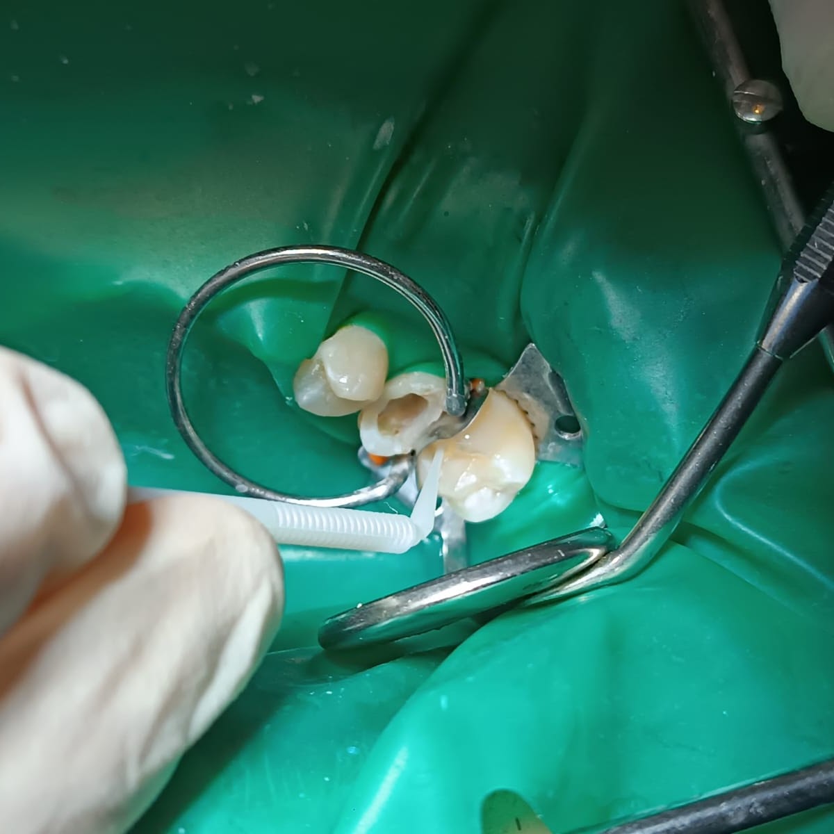 Endodonzia